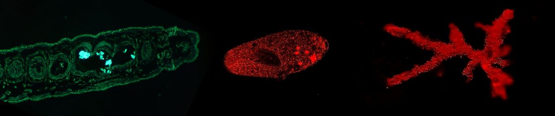 header_edlab_mikroplastik